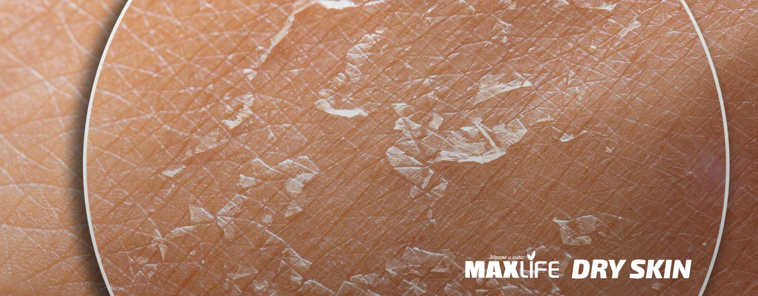 Dry Skin Suha Koja